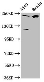 CABIN1 Antibody in Western Blot (WB)