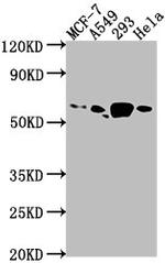 PDE1B Antibody in Western Blot (WB)