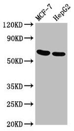 GNAS Antibody in Western Blot (WB)