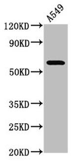 PDE9A Antibody in Western Blot (WB)