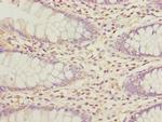 GALNT2 Antibody in Immunohistochemistry (Paraffin) (IHC (P))