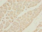 GALNT2 Antibody in Immunohistochemistry (Paraffin) (IHC (P))