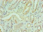 ILF3 Antibody in Immunohistochemistry (Paraffin) (IHC (P))