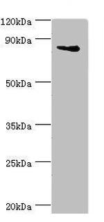 ILF3 Antibody in Western Blot (WB)