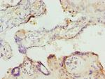 ITPK1 Antibody in Immunohistochemistry (Paraffin) (IHC (P))