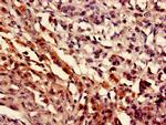 MEF2D Antibody in Immunohistochemistry (Paraffin) (IHC (P))