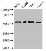 MEF2D Antibody in Western Blot (WB)