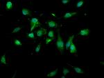 USP4 Antibody in Immunocytochemistry (ICC/IF)