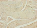 CALCOCO2 Antibody in Immunohistochemistry (Paraffin) (IHC (P))