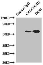 CALCOCO2 Antibody in Western Blot (WB)