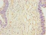 CALCOCO2 Antibody in Immunohistochemistry (Paraffin) (IHC (P))