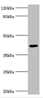 ABH1 Antibody in Western Blot (WB)