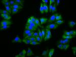 BFSP2 Antibody in Immunocytochemistry (ICC/IF)