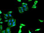 MAdCAM-1 Antibody in Immunocytochemistry (ICC/IF)