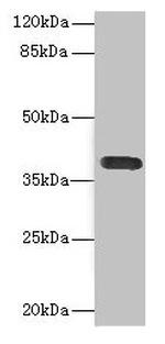 CD226 (DNAM-1) Antibody in Western Blot (WB)