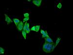 ETFDH Antibody in Immunocytochemistry (ICC/IF)