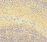 IKAROS Antibody in Immunohistochemistry (Paraffin) (IHC (P))