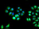 IL10RA Antibody in Immunocytochemistry (ICC/IF)