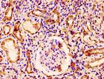 RAB3GAP1 Antibody in Immunohistochemistry (Paraffin) (IHC (P))