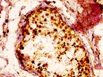 RAB3GAP1 Antibody in Immunohistochemistry (Paraffin) (IHC (P))