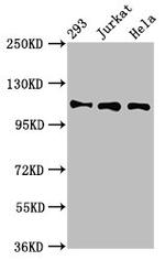 RAB3GAP1 Antibody in Western Blot (WB)