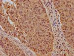 KPNB1 Antibody in Immunohistochemistry (Paraffin) (IHC (P))