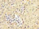 PCBP2 Antibody in Immunohistochemistry (Paraffin) (IHC (P))