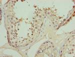 TRIP13 Antibody in Immunohistochemistry (Paraffin) (IHC (P))