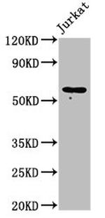 IL18R1 Antibody in Western Blot (WB)