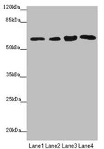 FBXO7 Antibody in Western Blot (WB)