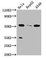 ZMYND17 Antibody in Western Blot (WB)