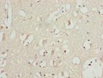 PITRM1 Antibody in Immunohistochemistry (Paraffin) (IHC (P))