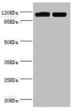 PITRM1 Antibody in Western Blot (WB)