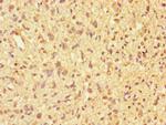 PPP2R2D Antibody in Immunohistochemistry (Paraffin) (IHC (P))