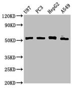 PPP2R2D Antibody in Western Blot (WB)