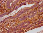 ZC3H14 Antibody in Immunohistochemistry (Paraffin) (IHC (P))