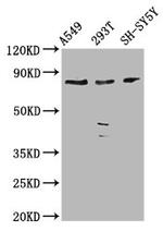 ZC3H14 Antibody in Western Blot (WB)