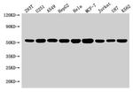 SLC25A24 Antibody in Western Blot (WB)