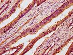 B3GNT6 Antibody in Immunohistochemistry (Paraffin) (IHC (P))