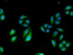 TCTN3 Antibody in Immunocytochemistry (ICC/IF)