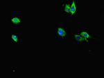 RAB12 Antibody in Immunocytochemistry (ICC/IF)