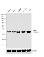 RAB12 Antibody in Western Blot (WB)