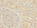 MTHFD1L Antibody in Immunohistochemistry (Paraffin) (IHC (P))