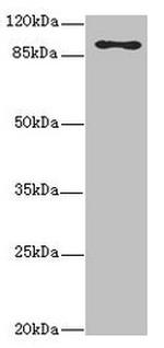 MTHFD1L Antibody in Western Blot (WB)