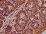 BAAT1 Antibody in Immunohistochemistry (Paraffin) (IHC (P))