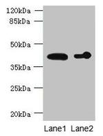 ASPHD2 Antibody in Western Blot (WB)