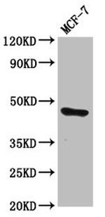 TFAP2E Antibody in Western Blot (WB)