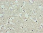 STOX1 Antibody in Immunohistochemistry (Paraffin) (IHC (P))