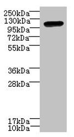 STOX1 Antibody in Western Blot (WB)