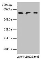 PLCZ1 Antibody in Western Blot (WB)